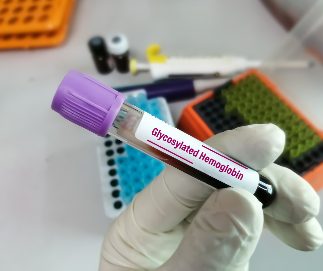 Glycosylated Hemoglobin Test